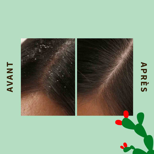 Pure Scrub détoxifiant pour le cuir chevelu